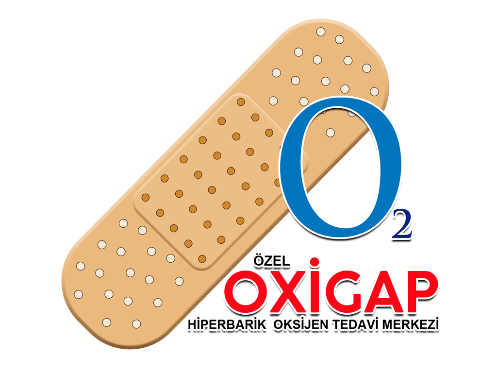 Oxigap Hiparbarik Oksijen Tedavi Merkezi websitesi ilkedesign tarafndan yaplmtr.